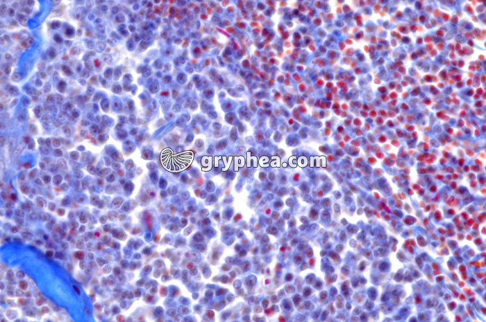 Ganglion lymphatique x160 - gryphea.com